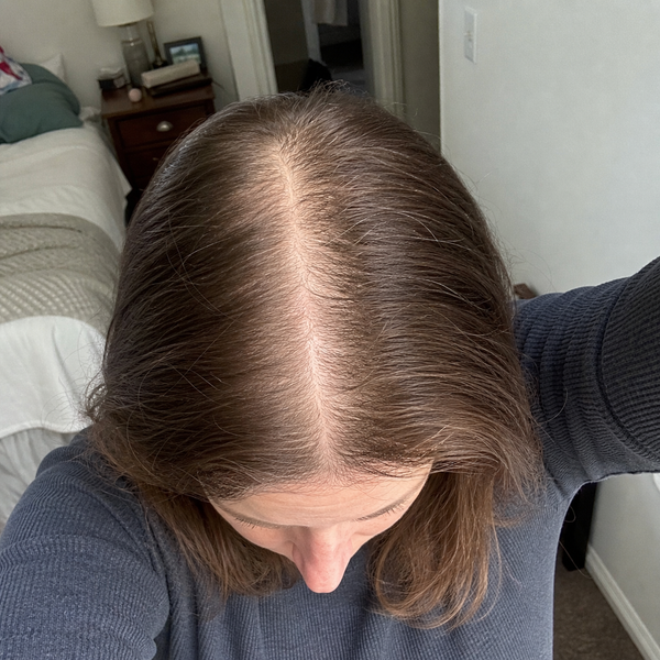 Before — Sarah K.