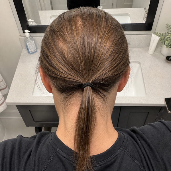 Before — Amanda T.