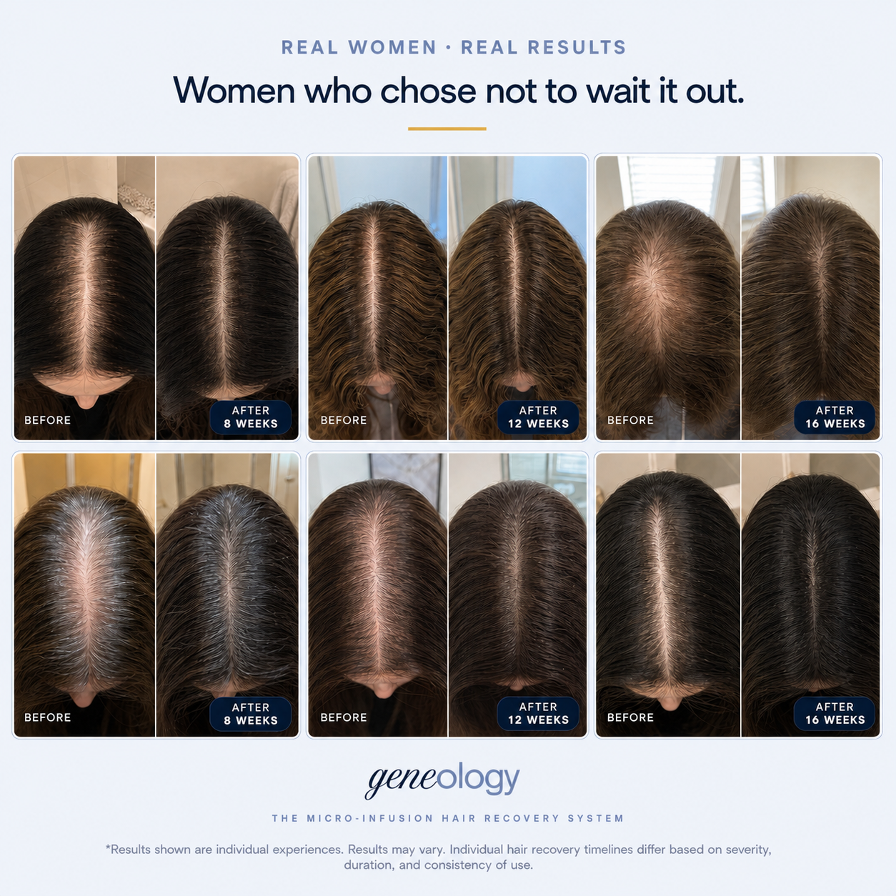 The Micro-Infusion Hair Recovery System